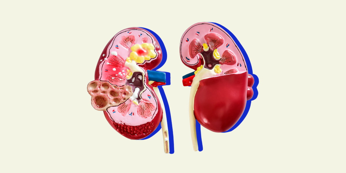 Three Common Misconceptions People Have About Organ Donation