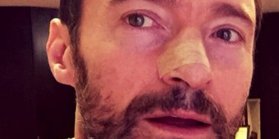 Hugh Jackman Shares Selfie Following Fifth Skin Cancer Removal
