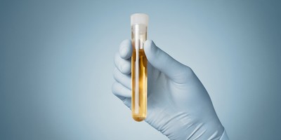 Aus Gov Is Trying to Re-Introduce Drug-Testing for Youth Welfare Recipients