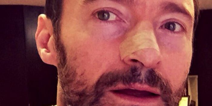 Hugh Jackman Shares Selfie Following Fifth Skin Cancer Removal