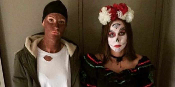 Opals Divided By Alice Kunek's Blackface Controversy; Twitter - Bafflingly - Turns Its Anger To Liz Cambage