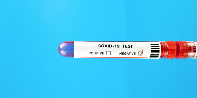 What On Earth is RAT Testing?