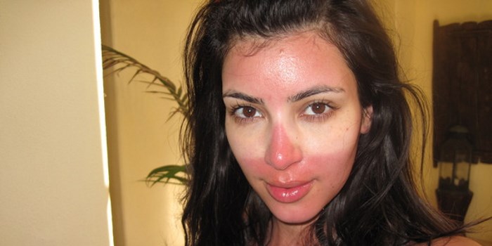 Ya Burnt? What You Need to Know About Sunscreen This Summer